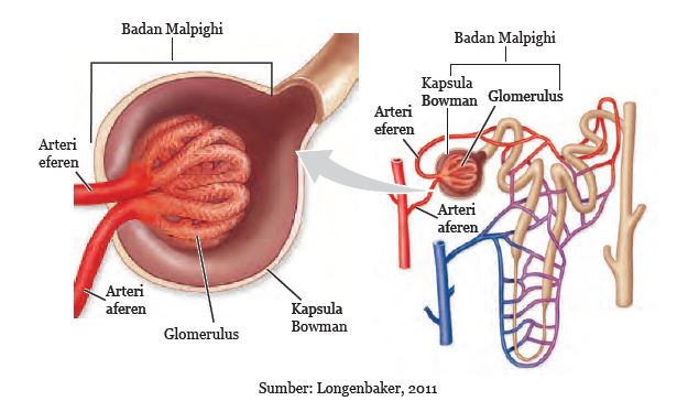 Gangguan pada ginjal yang ditandai dengan adanya kerusakan pada bagian glomerolus akibat bakteri streptococcus adalah ….